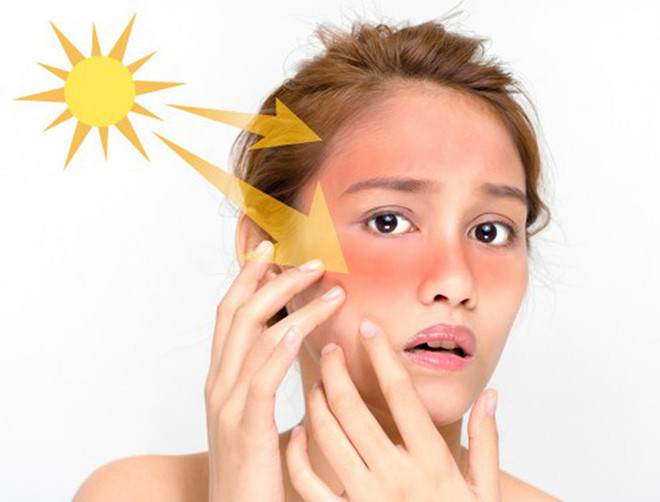 tránh tiếp xúc với ánh nắng mặt trời giảm nguy cơ mắc ung thư da